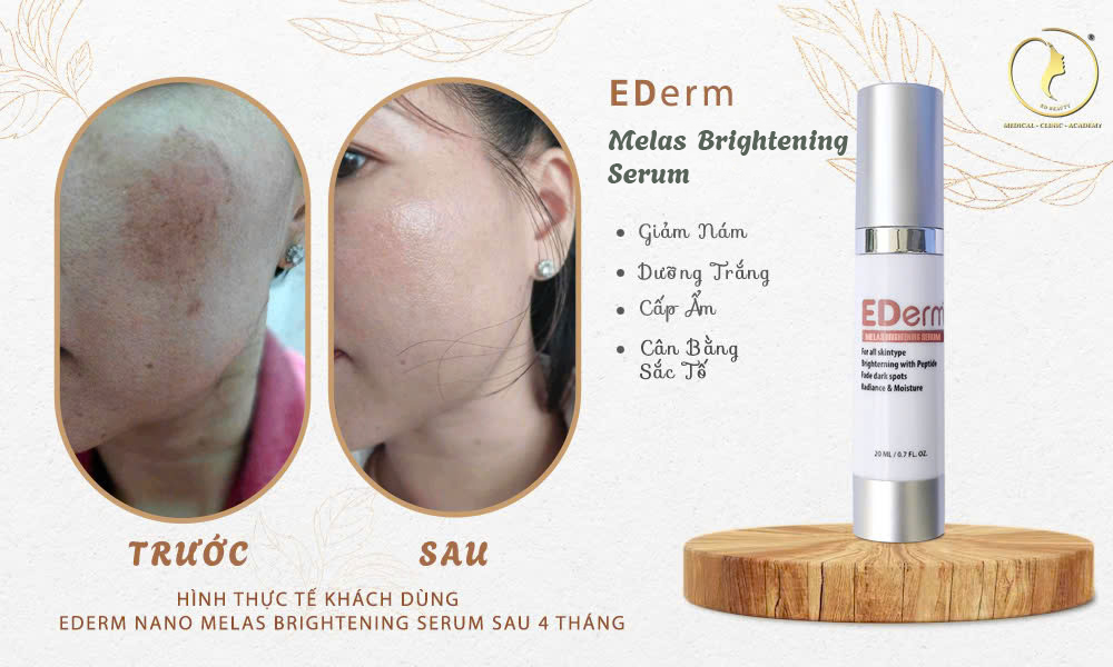 Công dụng chính EDerm Melas Brightening serum