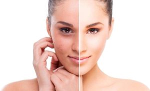 Cải thiện sắc tố da