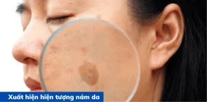 Bảo vệ da