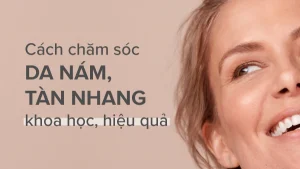chăm sóc da nám