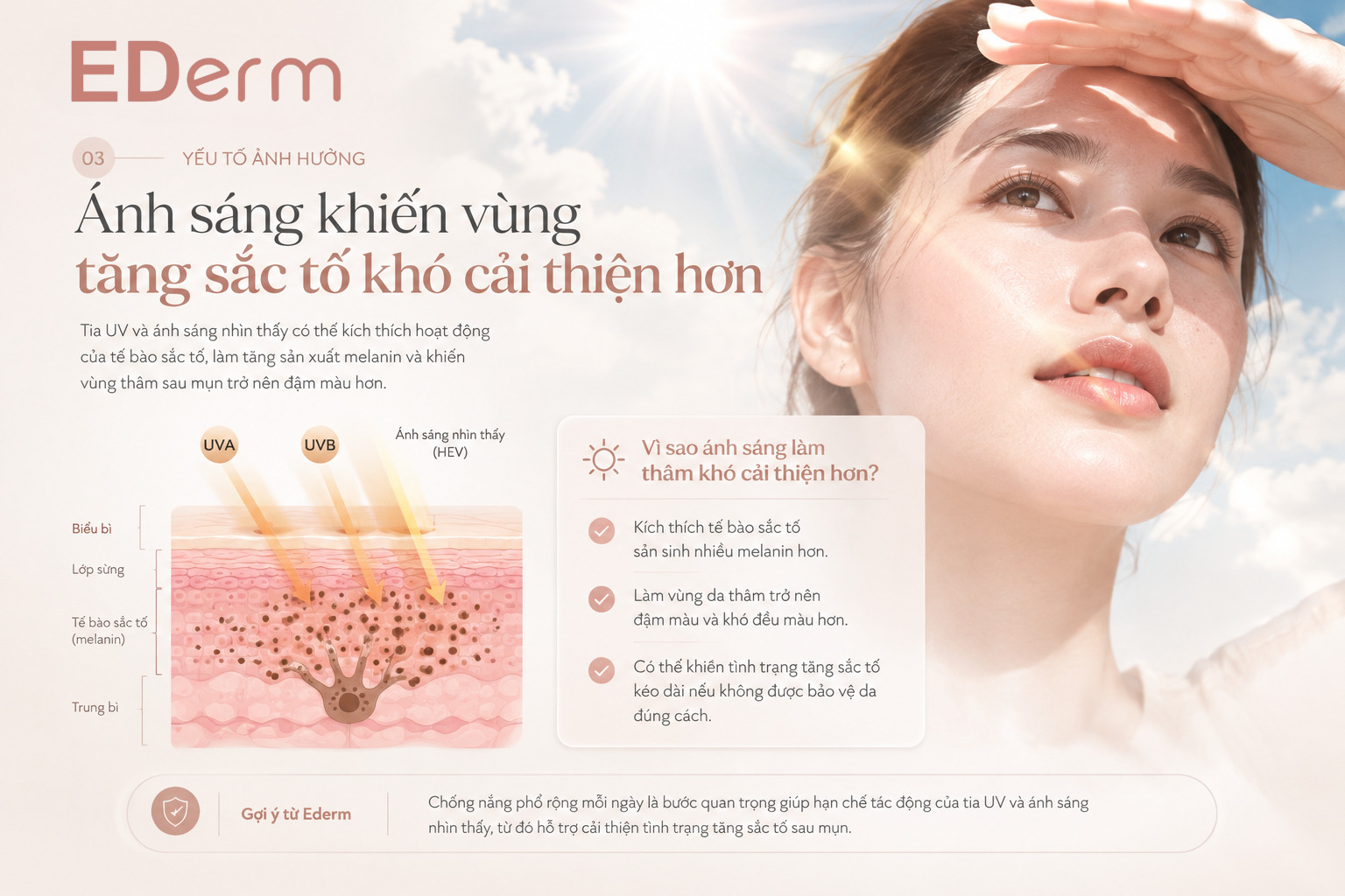 3. Ánh sáng có thể khiến vùng tăng sắc tố khó cải thiện hơn