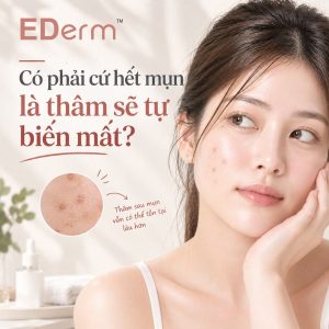 Thâm sau mụn bao lâu mới cải thiện Những yếu tố ảnh hưởng