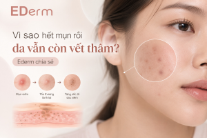 Vì sao hết mụn rồi da vẫn còn vết thâm Ederm chia sẻ
