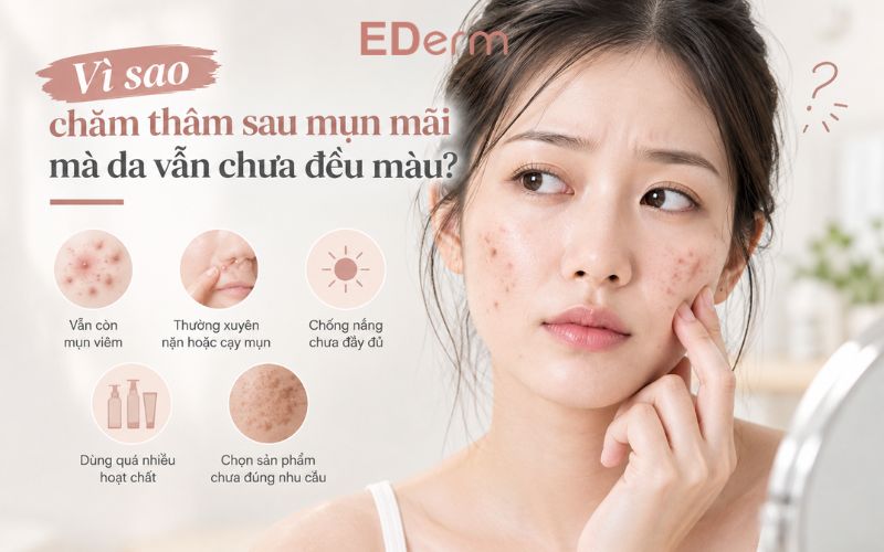 Vì sao chăm thâm sau mụn mãi mà da vẫn chưa đều màu